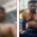 मोतिहारी: केसरिया में पैसे के विवाद में एसिड फेंका, आधा दर्जन लोग झुलसे,  चार नामजद